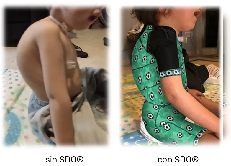 Second comparison of seated posture without the dynamic orthosis and with it